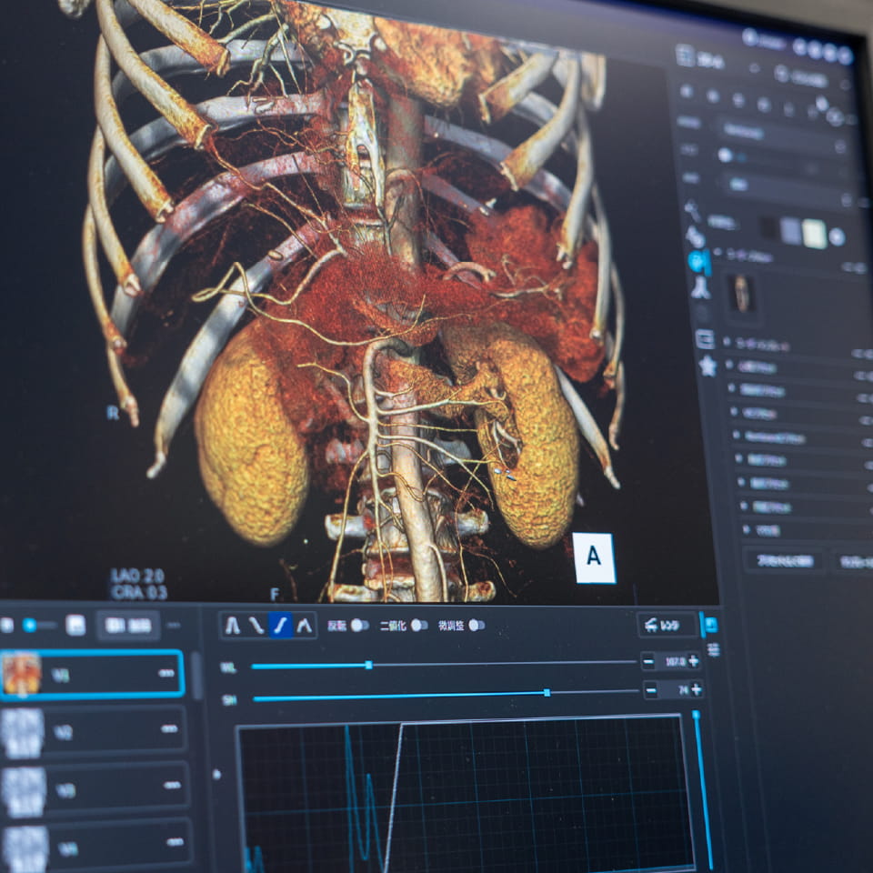 腹部血管系のVR（3D）画像